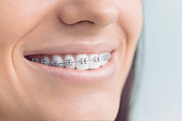 Best Tooth Extraction  in Logansport, LA